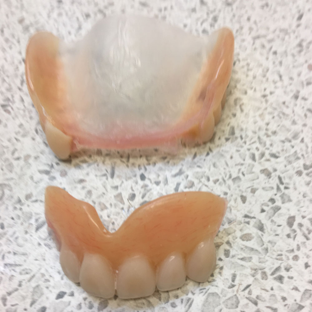 Repairs from The Denture Clinic, Canterbury